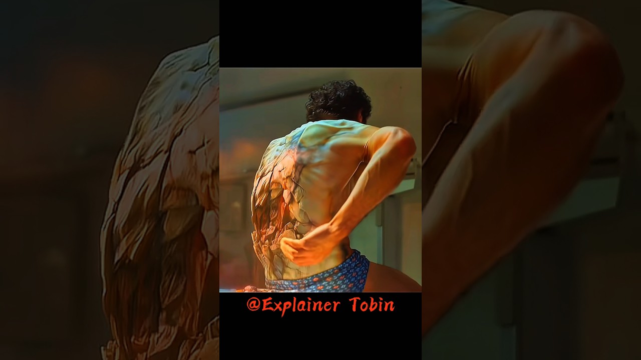 This is a strange virus 