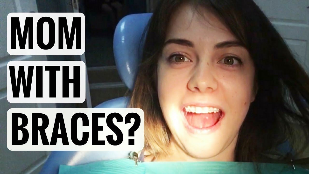 GETTING BRACES ON? FOR THE FIRST TIME! DOES IT HURT? Weekly VLOG