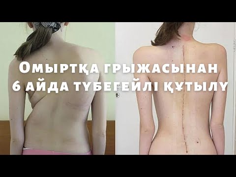 Омыртқа грыжасын 6 айда емдеп аласыз!