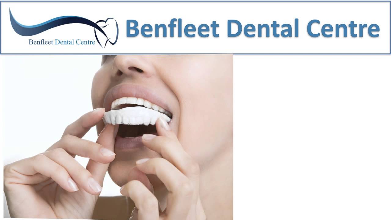 Benfleet Dental Whitening YouTube
