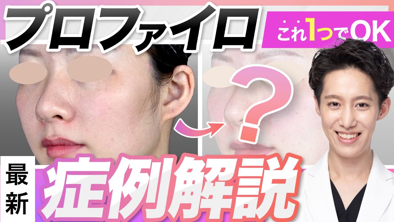 【若返り】次世代ヒアルロン酸！？プロファイロってどんな治療？