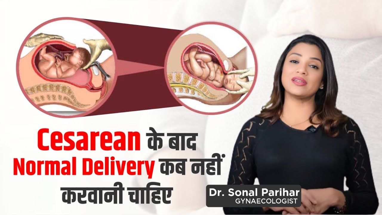 Cesarean के बाद   Normal Delivery कब नहीं करवानी चाहिए | Dr. Sonal Parihar