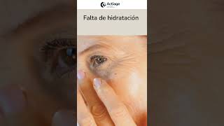 Sabes Cuáles Son Los 3 Enemigos De Las Arrugas?