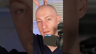 How Does A Hairline Impact A Hair Transplant?