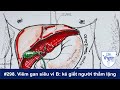 #298. Viêm gan siêu vi B: kẻ giết người thầm lặng