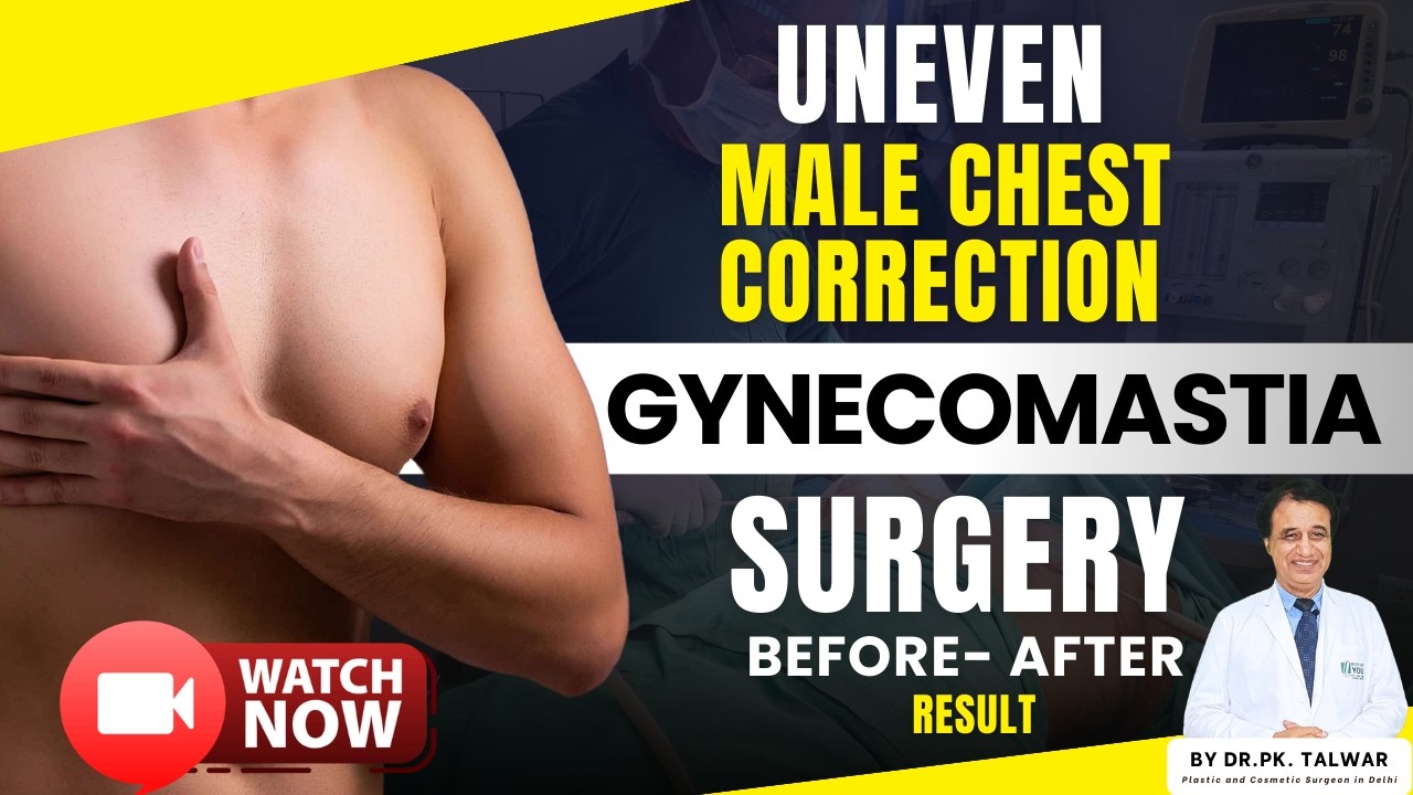 Asymmetry Gynecomastia Surgery Before & After | Uneven Chest Correction Explained | Dr. PK Talwar