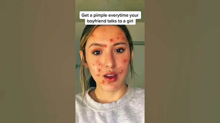 #pov you get a pimple everytime he talks to another girl #viral #story - DayDayNews