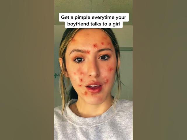 #pov you get a pimple everytime he talks to another girl #viral #story