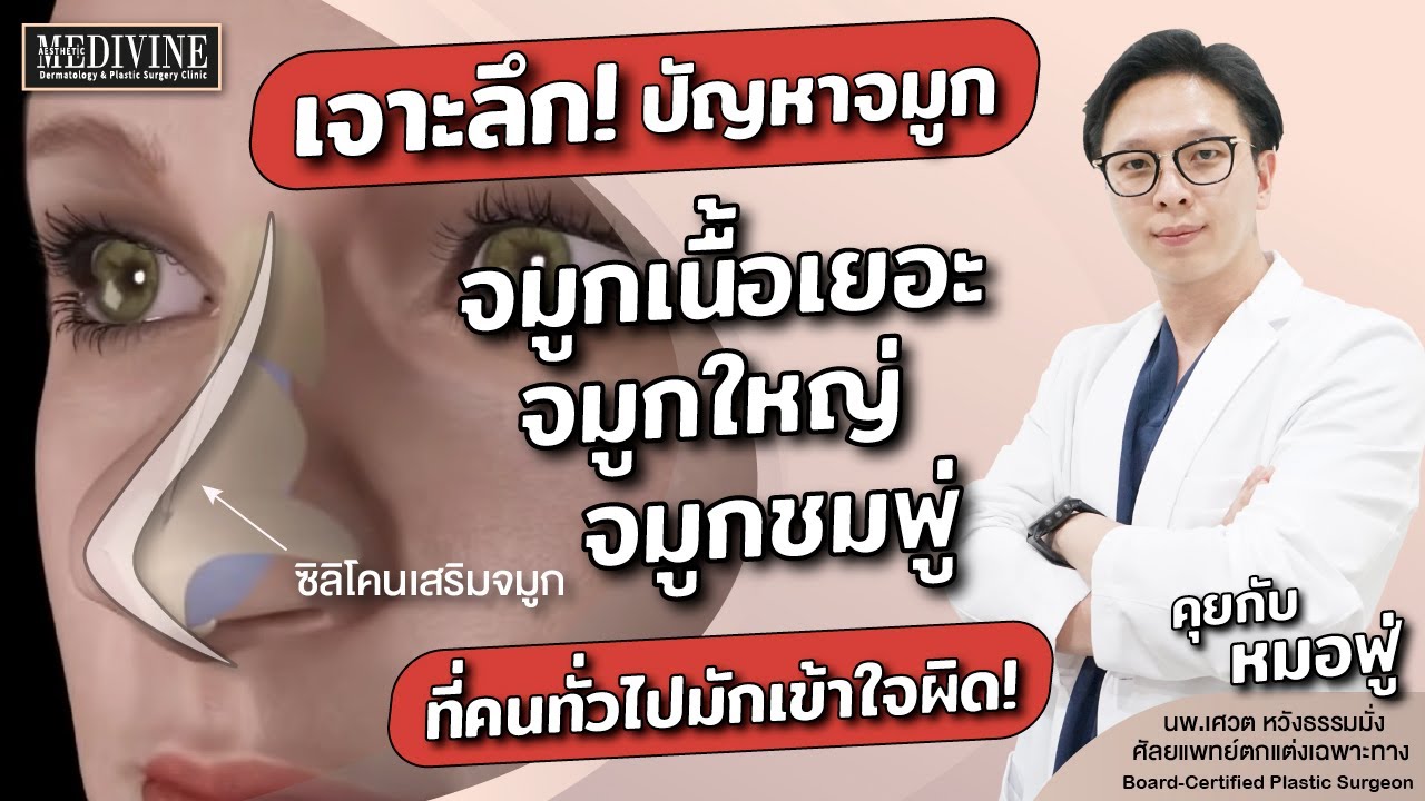 เจาะลึก! จมูกใหญ่ จมูกชมพู่ ต้องแก้ด้วยวิธีไหนดีที่สุด!! อย่าเพิ่งตัดสินใจทำถ้ายังไม่ได้ดูคลิปนี้!