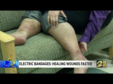 Electric Bandages: Healing