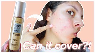 Maybelline Dream Radiant Liquid Hydrating Foundation Review on ACNE PRONE SKIN