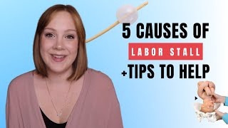 Top 5 Causes of Dilation/Labor Stall & What to Do About It!