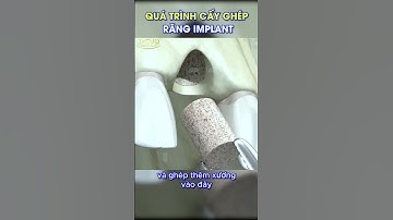 Procedure voor tandimplantaten (botvergroting) #shorts #tandheelkunde