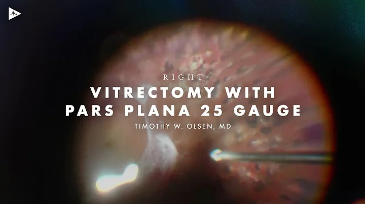 Right Vitrectomy by Timothy Olsen, MD | Preview