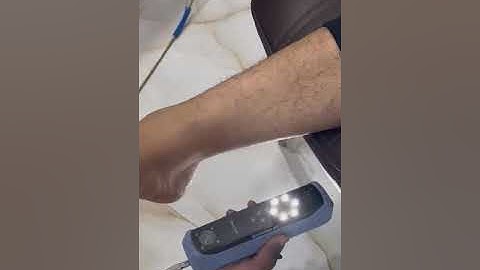 Foot scan using Einstar 3d Scanner