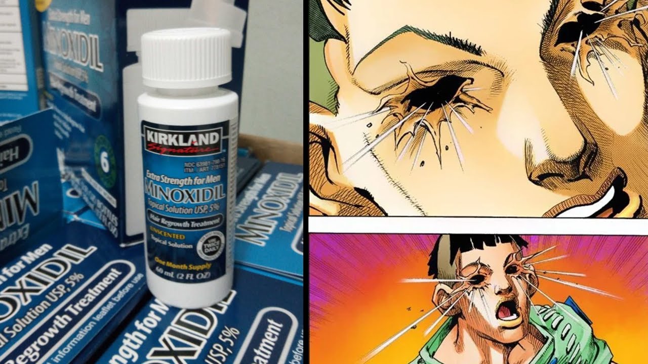 Propylene Glycol in Topical Minoxidil: Allergies, breakage, etc..