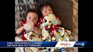 Iowa babies born at 22 weeks are now thriving, healthy toddlers