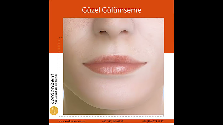 Diş Teli