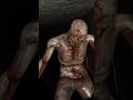 The Zombie attacked me