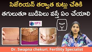 సిజేరియన్‌ కుట్లు బుడిపెల్లా తగిలితే ఏం చేయాలి |  Feeling Lump Around C-Section Incision | HFC screenshot 5