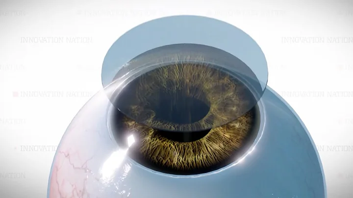 3D-Printed Cornea | The Henry Ford’s Innovation Nation