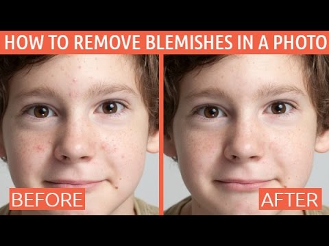 Best free photo editor blemishes