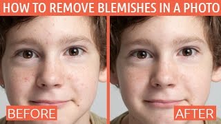 How to Remove Skin Blemishes, Spots, and Other Imperfections from Photos screenshot 5