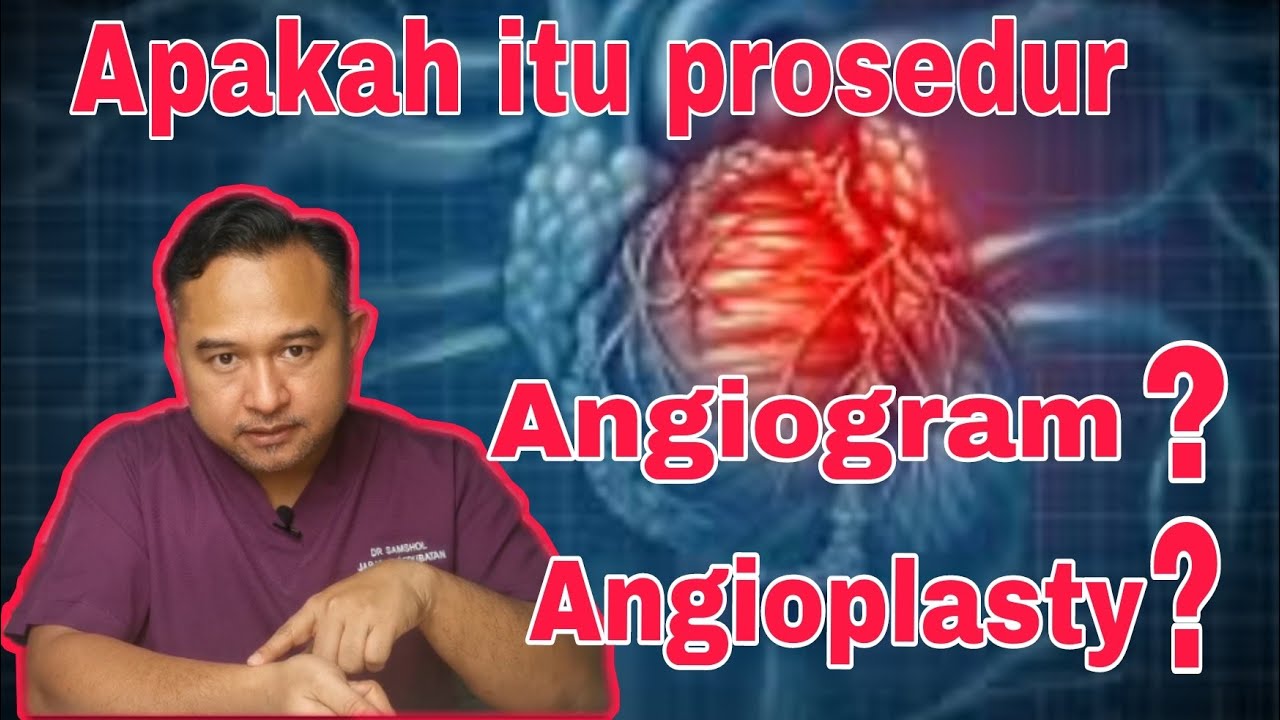 Apakah itu prosedur Angiogram dan Angioplasty yang perlu anda tahu
