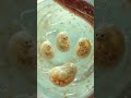Triplets Explained: How Identical and Fraternal Triplets Form #humanbiology #anatomy #bioscope