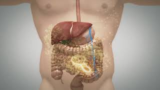 Liposome