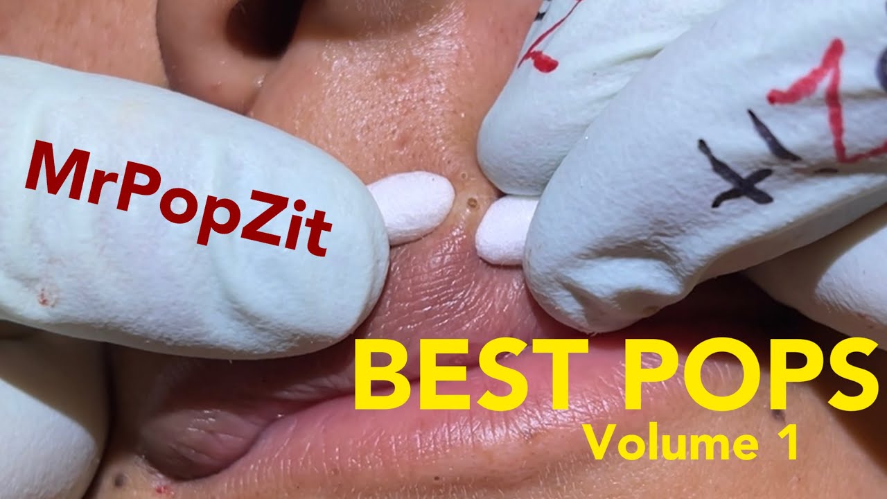 Top Pops volume 1. All kinds of pops from MrPopZit. Some new, some old.