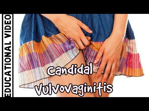 skin-diseases-awareness-|-candidal-vulvovaginitis-|-dr.-prajwal-pandey-|-नेपालीमा