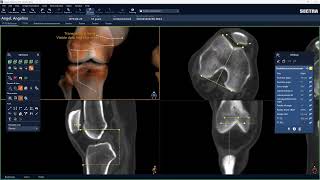 Sectra Ortho - Accessing Msk And Orthopedic Tools