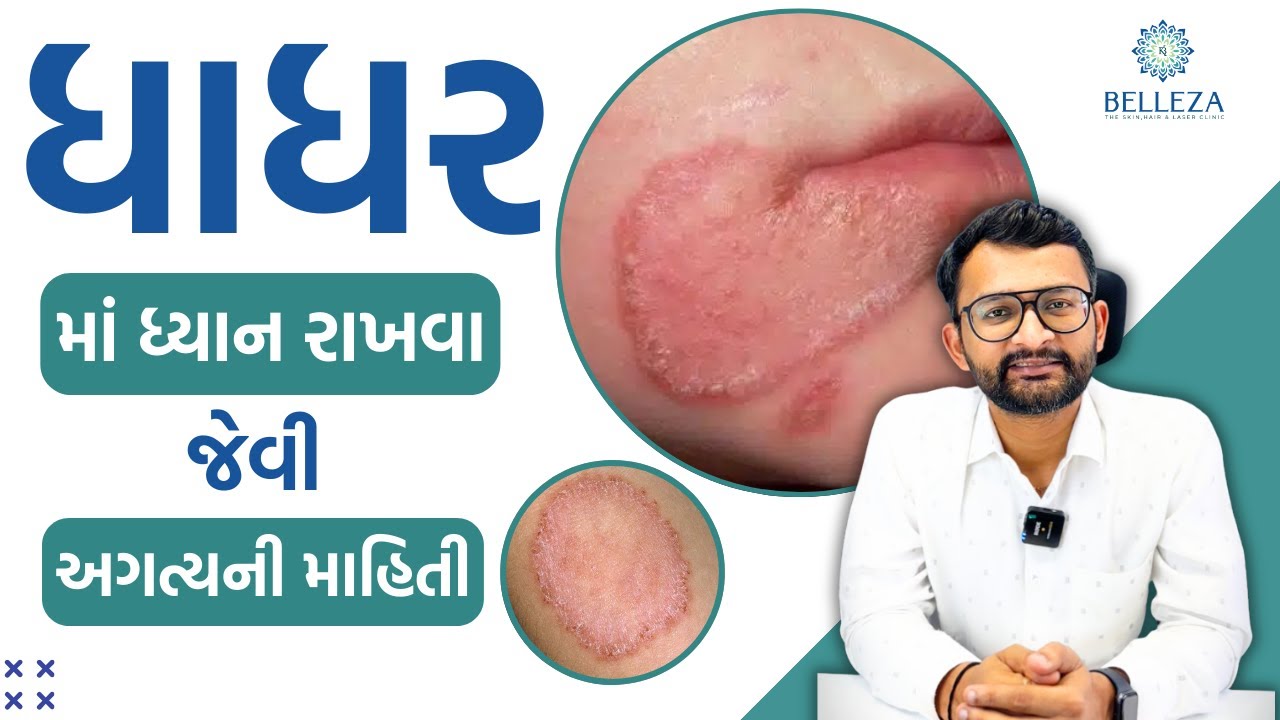 ધાધર માં ધ્યાન રાખવા જેવી અગત્યની માહિતી | Dr. Krishna Bhalala #fungalinfection  #skin   #skincare