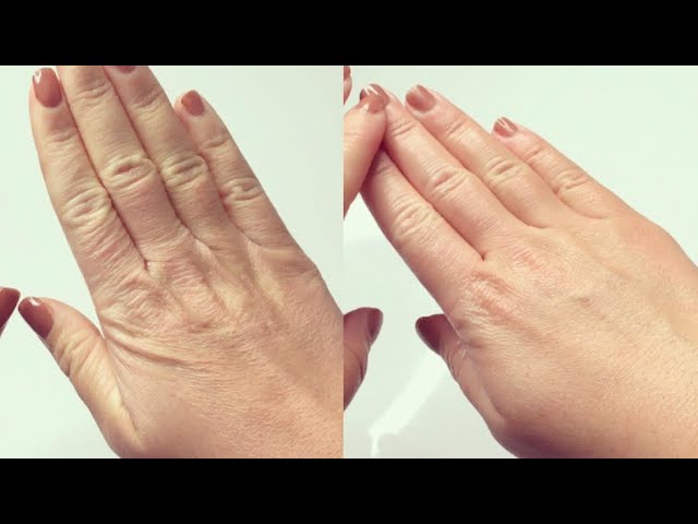 Trockene & Raue Hände schnell behandeln I Innerhalb Stunden zu weicher Haut  I Marina Si - YouTube