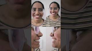 pre op vs post op