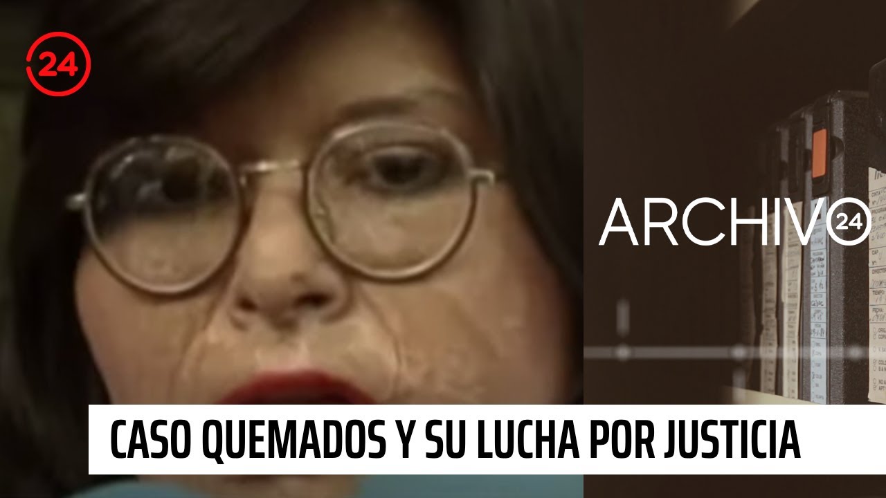 Archivo 24: Caso Quemados y sus 35 años de lucha por justicia | 24 Horas TVN Chile