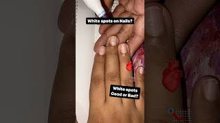 White Spots On Nails Palmistry Financial Loss Sign , Bad Health Sign