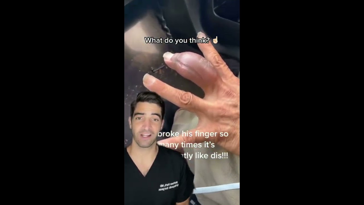 What To Do With A Swollen Finger