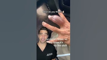 Thumbnail of What to do with a Swollen Finger