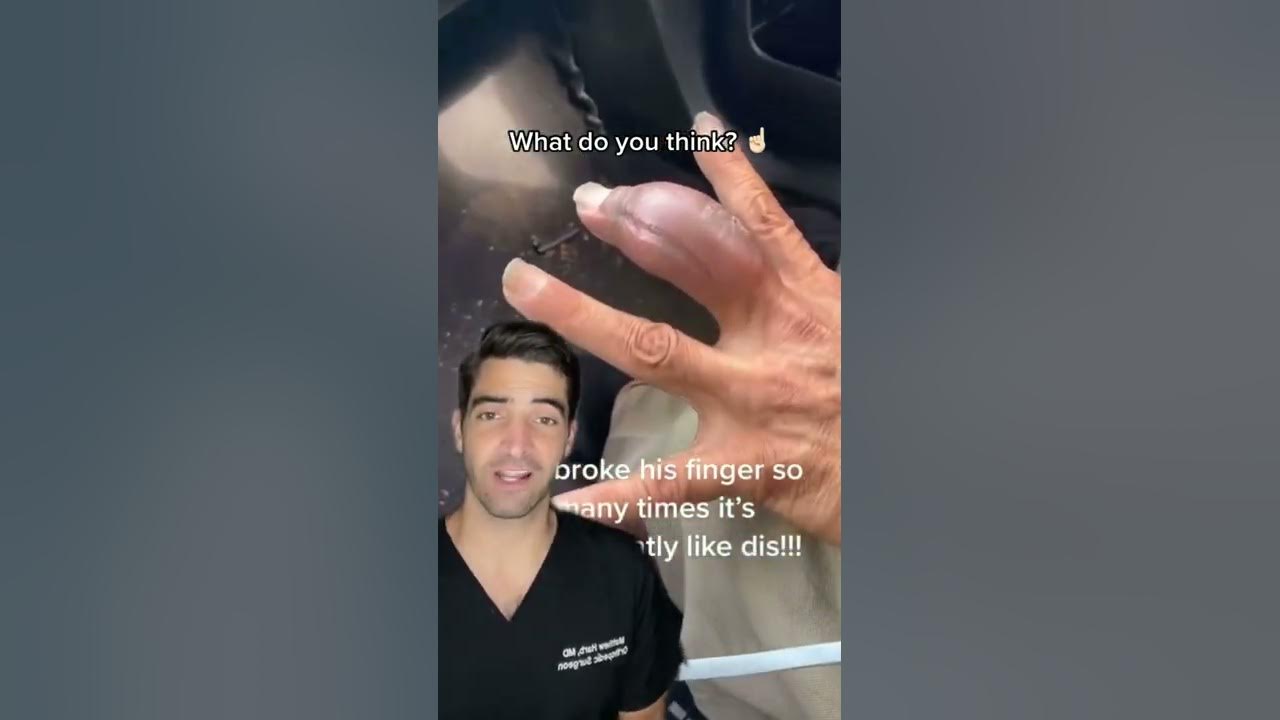 What to do with a Swollen Finger