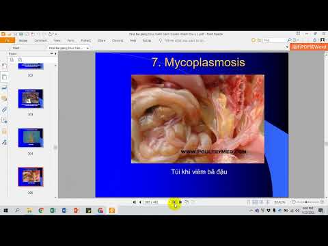Video Bài giảng chẩn đoán lâm sàng bệnh truyền nhiễm Phần... - youtube