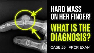 What is the Diagnosis? | MSK Radiology Case 55 screenshot 5
