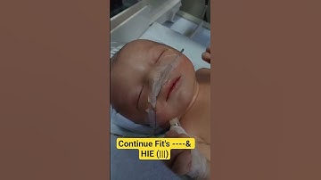 HIE Grade 3 Baby in NICU | Continuous Fits & Critical Care 😭.