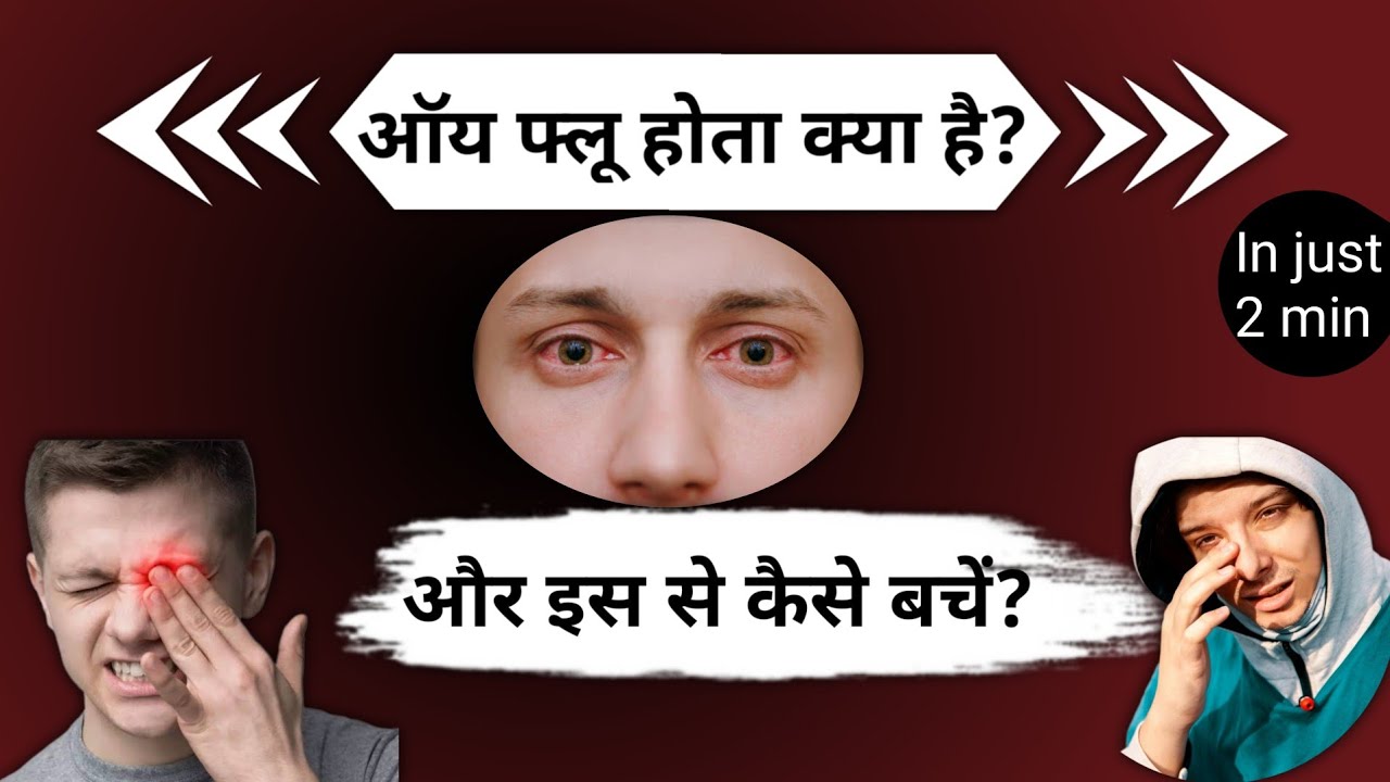 eye-flu-hone-par-kya-karen-eye-flue-india