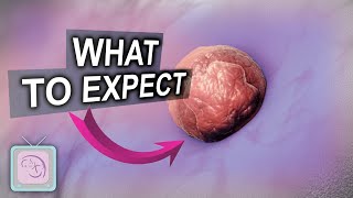 Embryo Transfer Day! Behind the Scenes! What to Expect!
