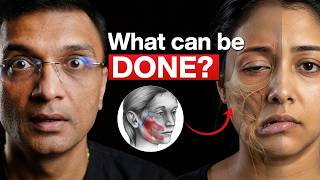 Sudden Facial Paralysis? It May Not Be a Stroke | Bell's Palsy Explained