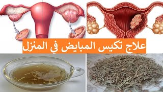 علاج تكيس المبايض بالاعشاب (في 4 دقائق) التكيسات على المبايض وعلاجها بالاعشاب