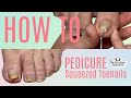 👣How to Pedicure on Squeezed Toenails👣