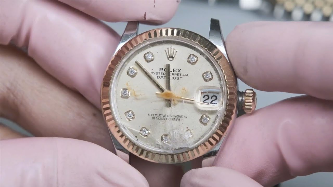 What family conditions can cause Rolex to be like this YouTube
